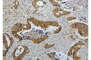 IHC analysis of RET using anti-RET antibody (ABIN6719502). (Ret Proto-Oncogene antibody  (AA 29-304))