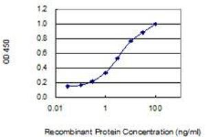 Detection limit for recombinant GST tagged WDR62 is 0. (WDR62 antibody  (AA 1-630))