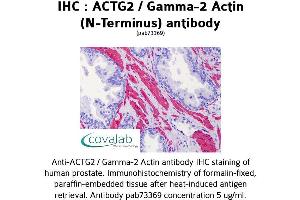 Image no. 2 for anti-Actin, gamma 2, Smooth Muscle, Enteric (ACTG2) antibody (ABIN1731474) (ACTG2 antibody)