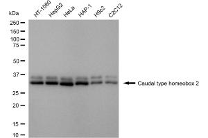Western blotting analysis using caudal type homeobox 2 antibody (ABIN7797943).