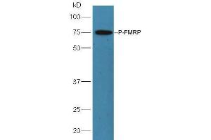 Lane 1: mouse brain lysates probed with Rabbit Anti-FMRP (Ser500) Polyclonal Antibody, Unconjugated  at 1:5000 for 90 min at 37˚C. (FMR1 antibody  (pSer500))