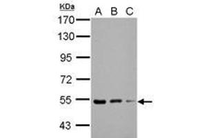 Image no. 2 for anti-Kelch Repeat and BTB (POZ) Domain Containing 4 (KBTBD4) (AA 287-518) antibody (ABIN1501896) (KBTBD4 antibody  (AA 287-518))