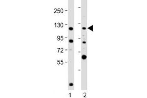 Western blot testing of human 1) K562 and 2) U-2OS cell lysate with NOP2 antibody at 1:2000. (Nucleolar Protein 2 (AA 9-43) antibody)