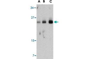 Western blot analysis of FABP7 in human breast tissue lysate with FABP7 polyclonal antibody  at (A) 0. (FABP7 antibody  (Internal Region))