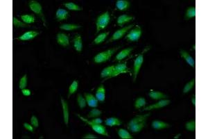 Immunofluorescence staining of Hela cells with ABIN7166993 at 1:100, counter-stained with DAPI. (RAB3GAP1 antibody  (Catalytic Subunit))