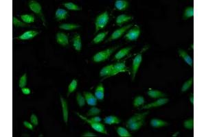 Immunofluorescence staining of Hela cells with ABIN7166993 at 1:100, counter-stained with DAPI. (RAB3GAP1 antibody  (Catalytic Subunit))