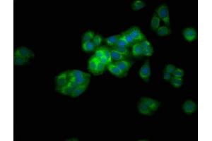Immunofluorescence staining of HepG2 cells with ABIN7144688 at 1:133, counter-stained with DAPI. (Arylsulfatase E antibody  (AA 352-494))