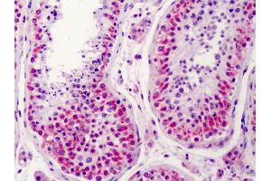 Anti-NEK2 antibody IHC of human testis. (NEK2 antibody  (AA 287-299))