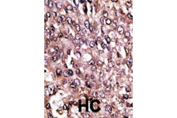 MAGEC1 antibody  (C-Term)