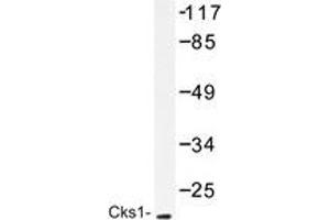 Western blot analysis of Cks1 antibody in extracts from Jurkat cells treated with serum 20% 15'.