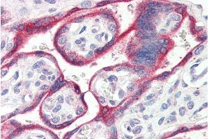 ABIN238672 (4µg/ml) staining of paraffin embedded Human Placenta. (Aromatase antibody  (Internal Region))