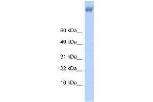 WB Suggested Anti-ZNF644 Antibody Titration:  0. (ZNF644 antibody  (Middle Region))
