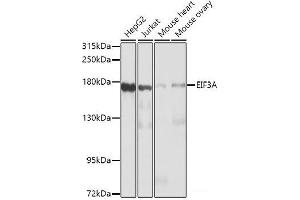 Western blot analysis of extracts of various cell lines using EIF3A Polyclonal Antibody at dilution of 1:1000.