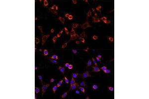 Immunofluorescence analysis of NIH/3T3 cells using OCLN antibody.