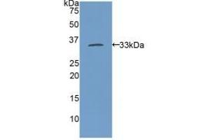 Detection of Recombinant MYH11, Rat using Polyclonal Antibody to Myosin Heavy Chain 11, Smooth Muscle (MYH11) (MYH11 antibody  (AA 211-482))