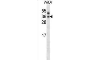 Western Blotting (WB) image for anti-Patatin-Like phospholipase Domain Containing 4 (PNPLA4) antibody (ABIN2997649)