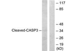 Western blot analysis of extracts from HeLa cells, treated with Etoposide 25uM 60', using Caspase 3 (Cleaved-Asp175) Antibody. (Caspase 3 antibody  (Cleaved-Asp175))