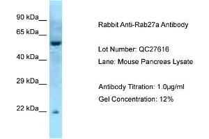 Host: Rabbit Target Name: Rab27a Sample Type: Mouse Pancreas Antibody Dilution: 1. (RAB27A antibody  (Middle Region))