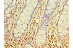 Immunohistochemistry of paraffin-embedded human colon tissue using ABIN7170540 at dilution of 1:100 (Spermidine Synthase antibody  (AA 1-302))