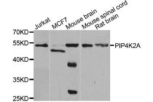 Western blot analysis of extracts of various cell lines, using PIP4K2A antibody.