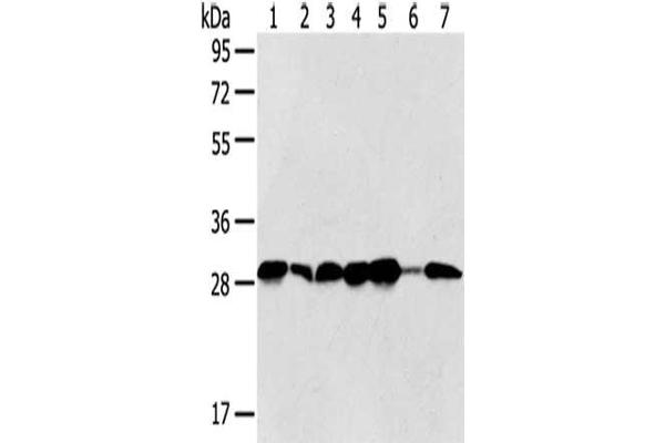 SRPRB antibody