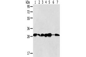 Gel: 8 % SDS-PAGE,Lysate: 40 μg,Lane 1-7: Jurkat cells, Hela cells, 293T cells, 231 cells, HepG2 cells, Human normal liver tissue, Human bladder carcinoma tissue,Primary antibody: ABIN7128021(SRPRB Antibody) at dilution 1/500 dilution,Secondary antibody: Goat anti rabbit IgG at 1/8000 dilution,Exposure time: 5 seconds (SRPRB antibody)