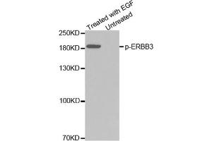 Western blot analysis of extracts from A431 cells using Phospho-ERBB3-Y1328 Antibody. (ERBB3 antibody  (pTyr1328))