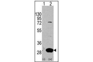 Western blot analysis of Latexin (arrow) in 293 cell lysates (2 µg/lane) either nontransfected (Lane 1) or transiently transfected with the LXN gene (Lane 2) (Latexin antibody  (Center))