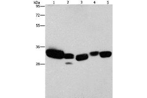 Western Blot analysis of Mouse liver and Human fetal lung tissue, hela cell and Mouse kidney tissue, Human brain malignant glioma tissue using CBR1 Polyclonal Antibody at dilution of 1:900 (CBR1 antibody)
