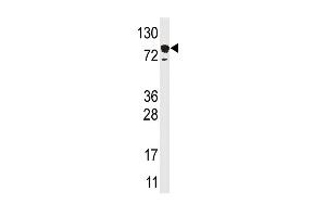 Western blot analysis of anti-EPS15 Pab in HL60 cell line lysate (35ug/lane) (EPS15 antibody  (C-Term))