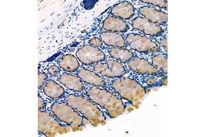 Immunohistochemistry of paraffin embedded rat colon using FCGBP (ABIN7073926) at dilution of 1:800 (250x lens)