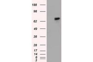 Western Blotting (WB) image for anti-Sorting Nexin 9 (SNX9) antibody (ABIN1501047) (SNX9 antibody)