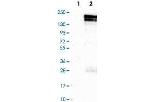 Western Blot analysis of Lane 1: negative control (vector only transfected HEK293T cell lysate) and Lane 2: over-expression lysate (co-expressed with a C-terminal myc-DDK tag in mammalian HEK293T cells) with KDM5B polyclonal antibody . (KDM5B antibody)