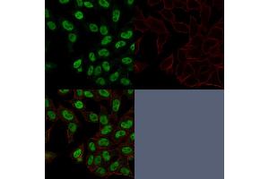 Confocal Immunofluorescence image of HeLa cells using Topo II alpha, Monoclonal Antibody (TOP2A/1362).