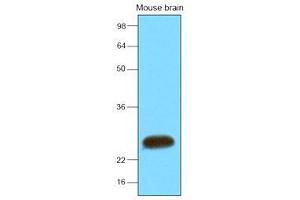 The extracts of mouse brain (30 ug) were resolved by SDS-PAGE, transferred to nitrocellulose membrane and probed with anti-human SNAP25 (1:2000). (SNAP25 antibody  (AA 1-206))