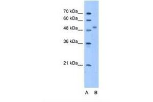 Image no. 1 for anti-Zinc Finger Protein 763 (ZNF763) (AA 51-100) antibody (ABIN341644) (ZNF763 antibody  (AA 51-100))