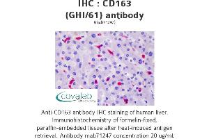 Image no. 3 for anti-CD163 (CD163) antibody (ABIN1721750) (CD163 antibody)