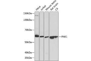 Western blot analysis of extracts of various cell lines, using P antibody (ABIN7269144) at 1:1000 dilution. (PAK1 antibody)