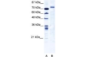 WB Suggested Anti-TRIM9 Antibody   Titration: 2. (TRIM9 antibody  (C-Term))