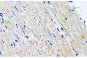 Immunohistochemistry of paraffin-embedded Mouse heart using HYAL1 Polyclonal Antibody at dilution of 1:100 (40x lens). (HYAL1 antibody)