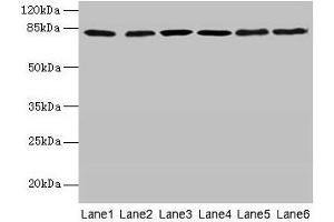 Western blot All lanes: CAPN1 antibody at 6 μg/mL Lane 1: A375 whole cell lysate Lane 2: 293T whole cell lysate Lane 3: PC-3 whole cell lysate Lane 4: Jurkat whole cell lysate Lane 5: Hela whole cell lysate Lane 6: A2780 whole cell lysate Secondary Goat polyclonal to rabbit IgG at 1/10000 dilution Predicted band size: 82 kDa Observed band size: 82 kDa (CAPNL1 antibody  (Catalytic Subunit))