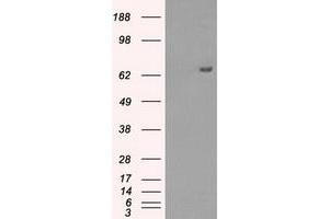 Western Blotting (WB) image for anti-Histone Deacetylase 10 (HDAC10) antibody (ABIN1498615) (HDAC10 antibody)