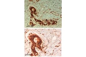 Immunohistochemistry of Rabbit anti ABCB5 antibody. (ABCB5 antibody  (Internal Region))