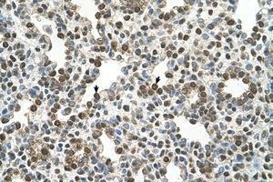 Image no. 1 for anti-Oxysterol Binding Protein-Like 9 (OSBPL9) (AA 73-122) antibody (ABIN6736683) (OSBPL9 antibody  (AA 73-122))