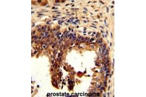 Immunohistochemistry (IHC) image for anti-Keratin 4 (KRT4) antibody (ABIN3002775) (KRT4 antibody)