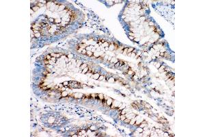 Immunohistochemistry (IHC) image for anti-Insulin-Like Growth Factor 2 Receptor (IGF2R) (AA 2475-2491), (C-Term) antibody (ABIN3044000)