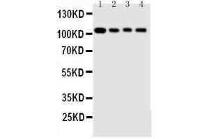 Anti-Hsp105 antibody, Western blotting Lane 1: Rat Ovary Tissue Lysate Lane 2: A549 Cell Lysate Lane 3: U87 Cell Lysate Lane 4: HELA Cell Lysate (HSPH1 antibody  (C-Term))