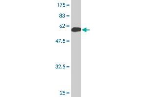 Western Blot detection against Immunogen (53. (14-3-3 sigma/SFN antibody  (AA 1-248))