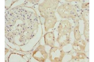 Immunohistochemistry of paraffin-embedded human kidney tissue using ABIN7169101 at dilution of 1:100 (NEK3 antibody  (AA 267-506))