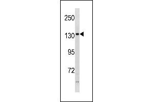 PHKA2 Antibody (N-term) (ABIN1881651 and ABIN2843259) western blot analysis in ZR-75-1 cell line lysates (35 μg/lane). (PHKA2 antibody  (N-Term))